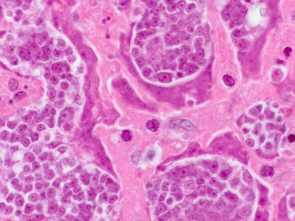 Research into parasites in one person