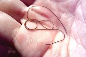 Worm parasite from the human body