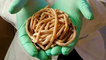 Methods for eliminating parasites from the body