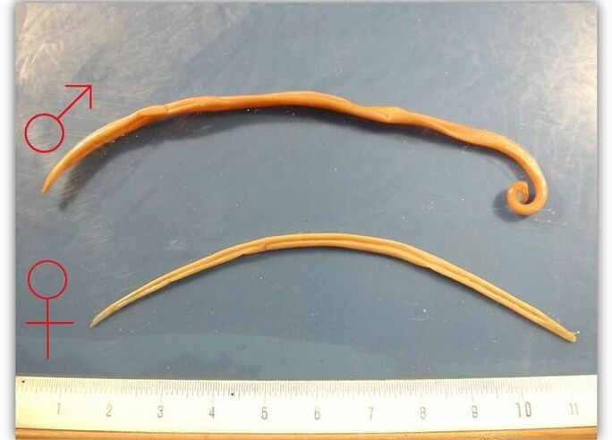 Size of roundworms – worms that infect the respiratory tract of adults